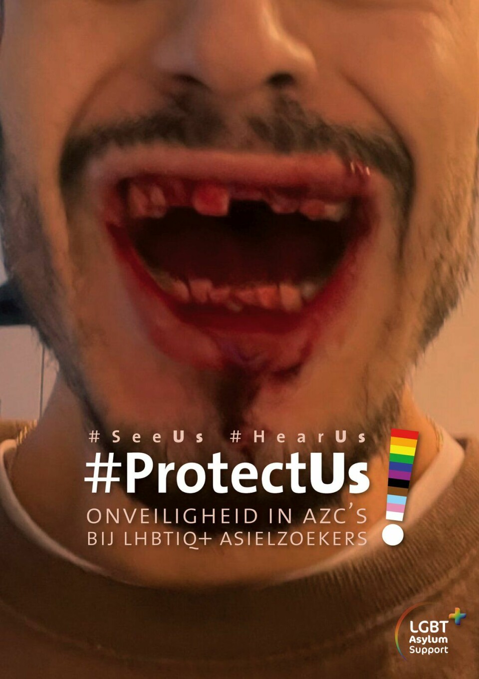 Protect Us